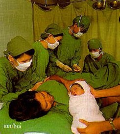 การทำคลอดแบบใหม่