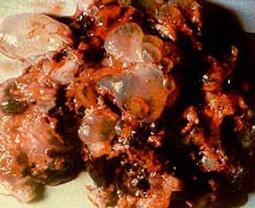 ครรภ์ไข่ปลาอุก