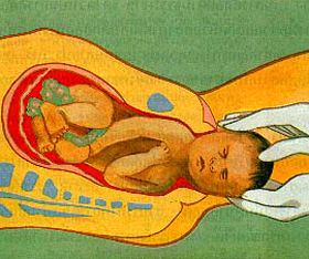 คลอดลูก
