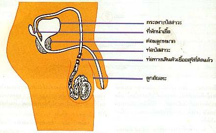 แผนภาพแสดงวิธีการทำหมันชาย